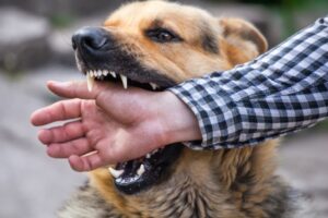 How Much Can You Sue for a Dog Attack