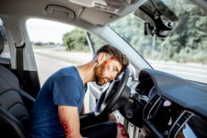 Can a Car Accident Cause Brain Injury