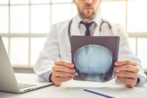 Common Types of Brain Injuries Associated with Car Accidents
