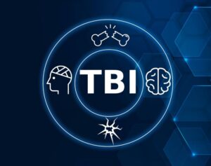 TBI (Traumatic Brain Injury) is a medical condition that occurs from a blow, jolt, or penetrating injury to the head, disrupting normal brain function.