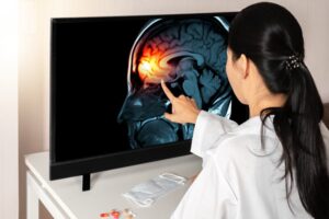 A female doctor is touching the screen of a monitor displaying an X-ray of a brain and skull. This image represents concepts such as headache, meningitis, and migraine.