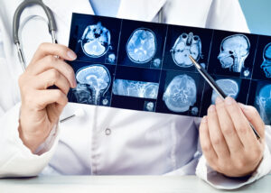 Denver traumatic brain injury lawyers